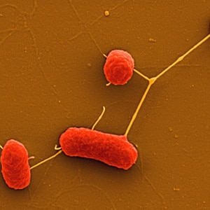 E-coli