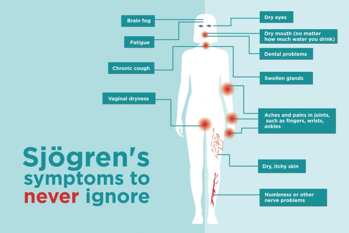 Evidências de que os adjuvantes das Vacinas podem ser perigosos: Sintomas do Síndrome de Sjogren
